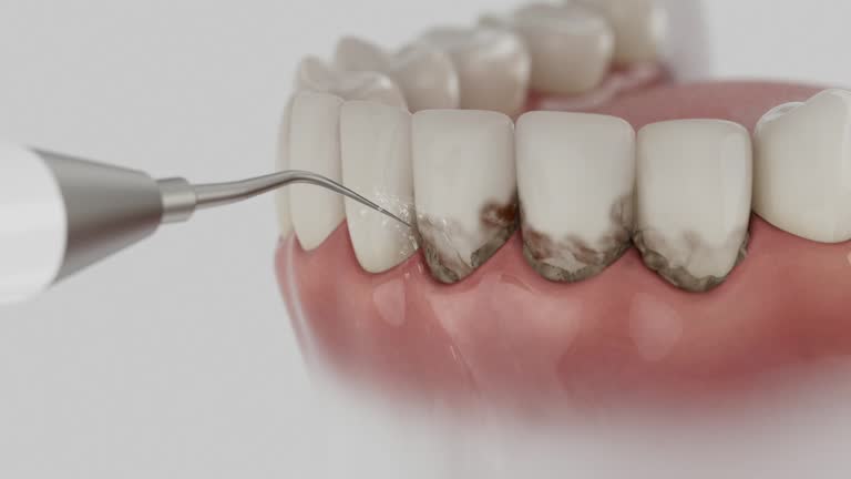 Reliable Tooth Extraction contractor in Yardville, NJ by Smile Center Dentistry